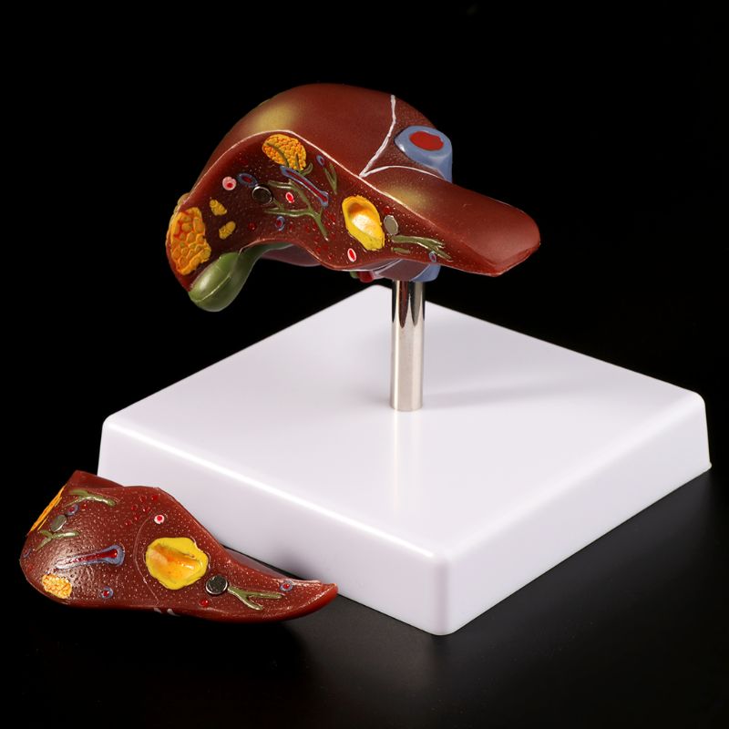 Human Liver Pathological Anato - Medical Lab Assistant ulasan dan harga