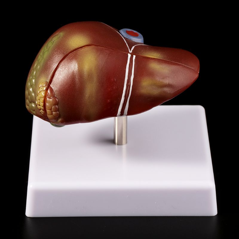 Human Liver Pathological Anato - Medical Lab Assistant ulasan dan harga