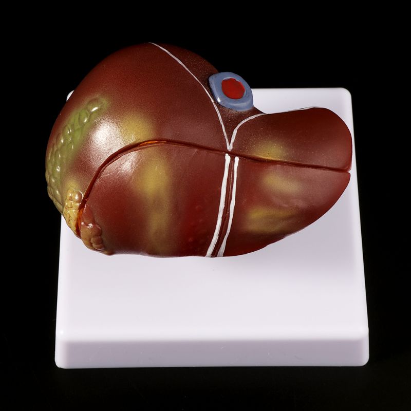 Human Liver Pathological Anato - Medical Lab Assistant ulasan dan harga