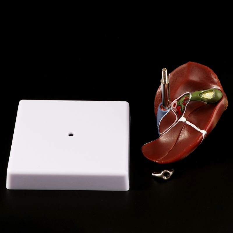 Human Liver Pathological Anato - Medical Lab Assistant ulasan dan harga