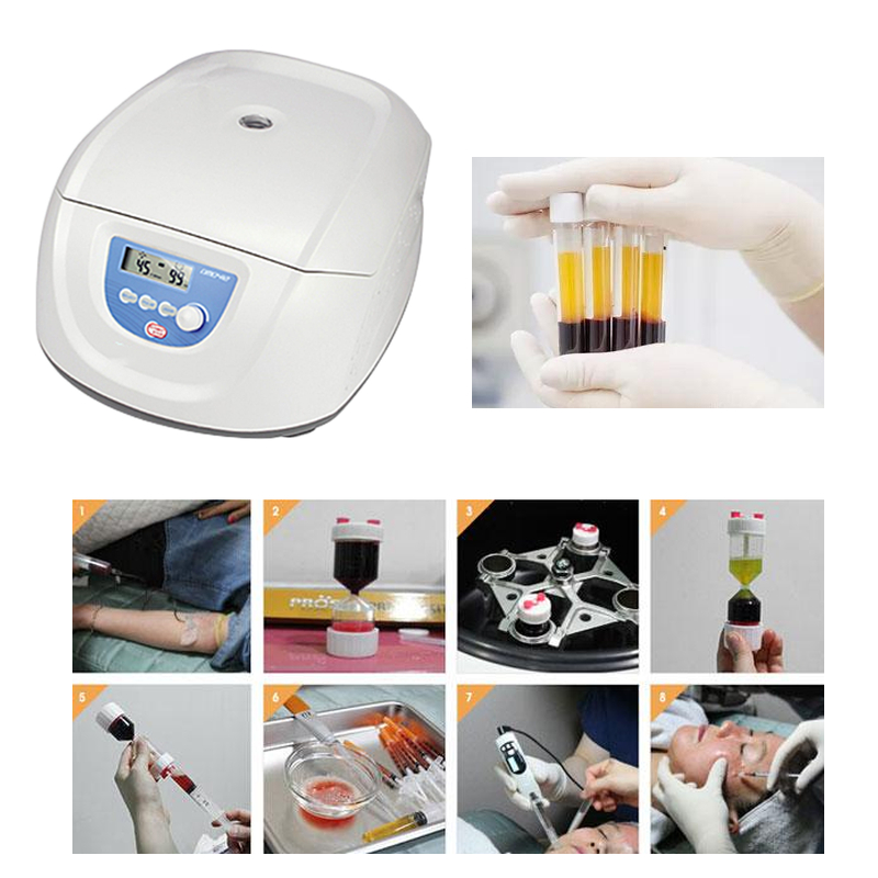 Best Seller Medical Blood PRP  - Medical Lab Center ulasan dan harga